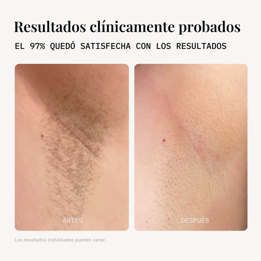IPL lumira S10 pro